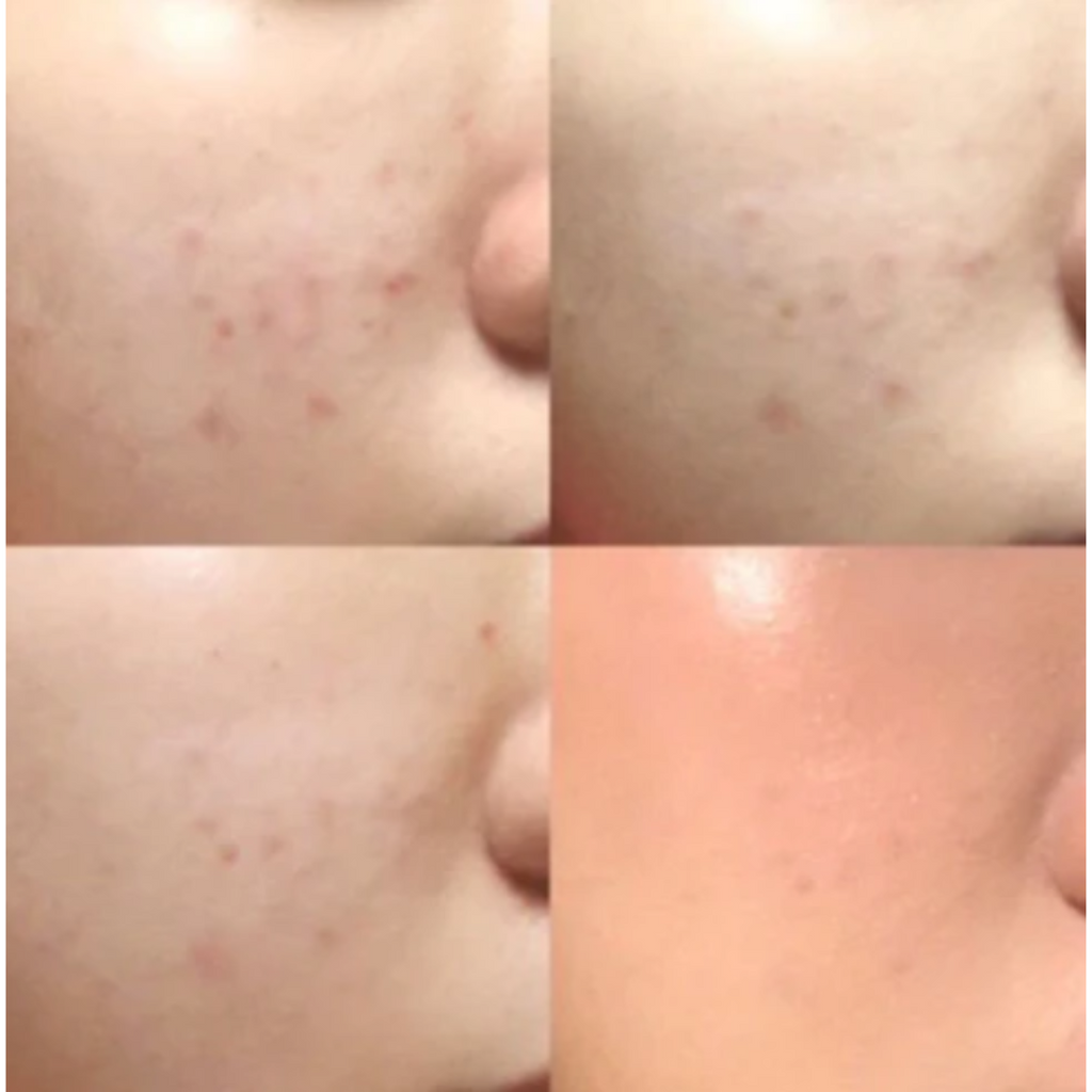 Mixsoon Glow Bean Essence – Hydrate & Heal (50ml)